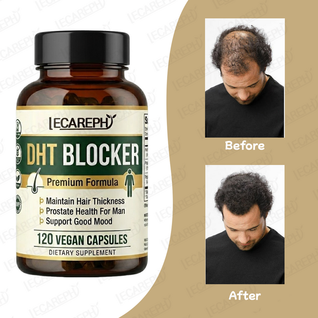 High Quality Dht Blocker Hair Capsules 5000Mcg Biotin Hair Growth and Dht Blocker Supplement